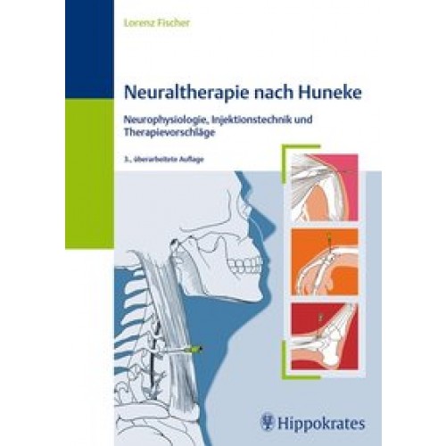 Neuraltherapie nach Huneke