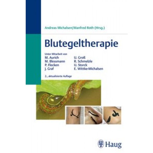 Blutegeltherapie