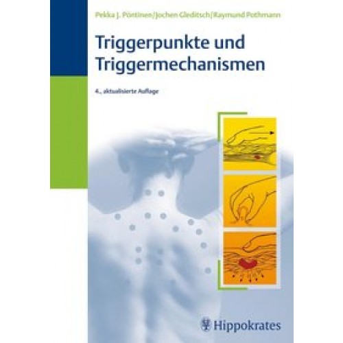 Triggerpunkte und Triggermechanismen